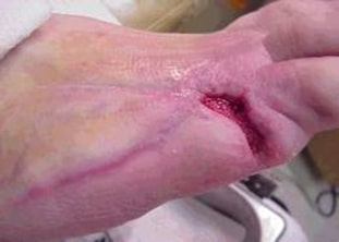 wound-care-1-1-1